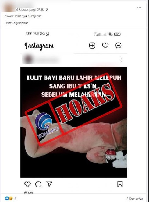 [HOAKS] Kulit Bayi Baru Lahir Melepuh karena Sang Ibu Divaksin Covid-19
